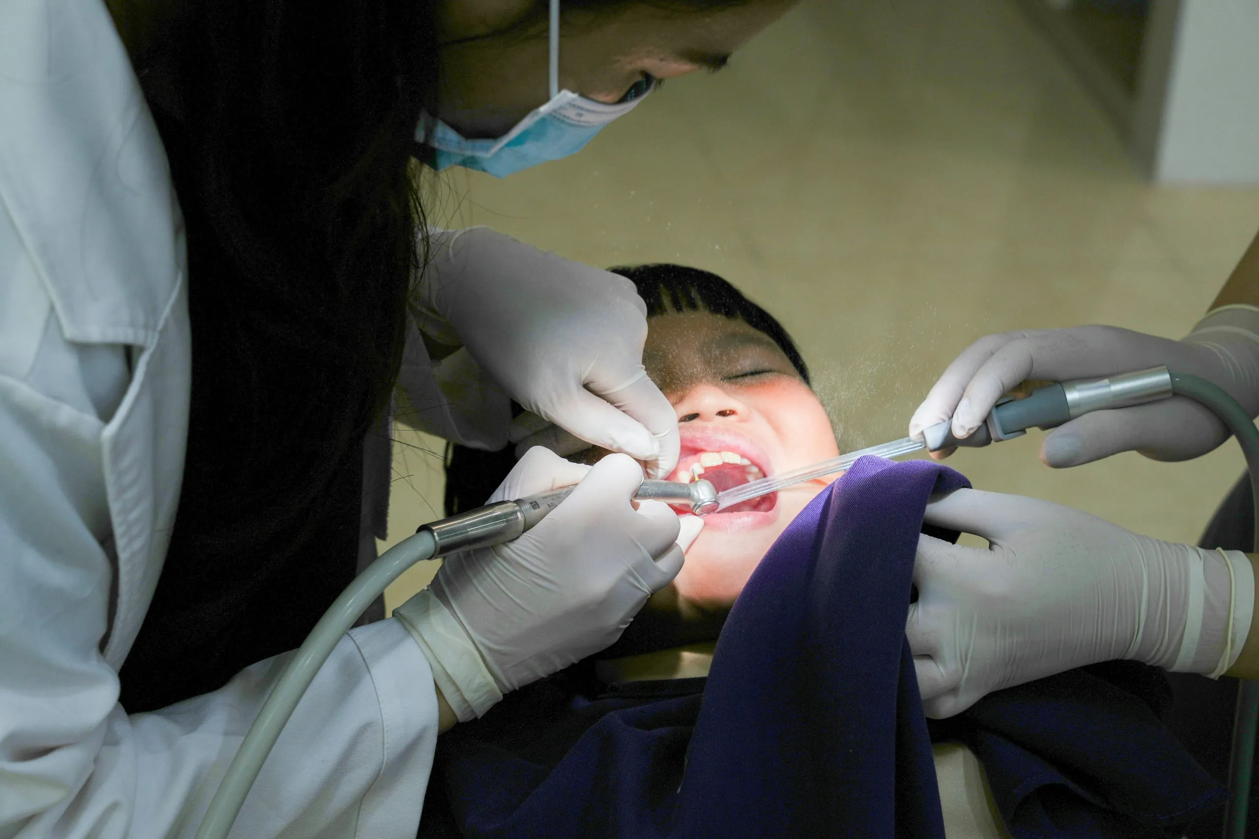 Importance of Root Canal Therapy in Preventing Tooth Loss